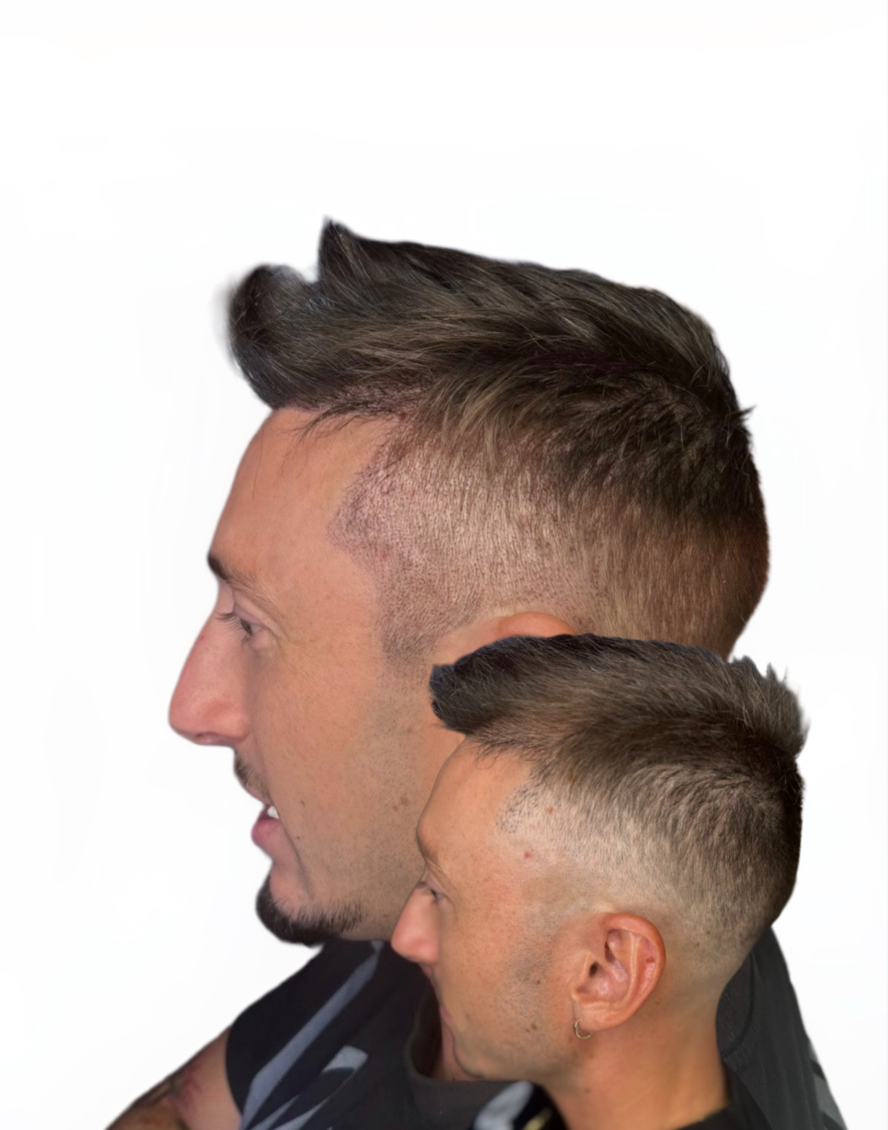 Side profile temple and scar blending for a male client